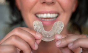 Bruxism Tullahoma