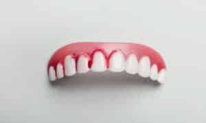 Tooth decay & gum disease