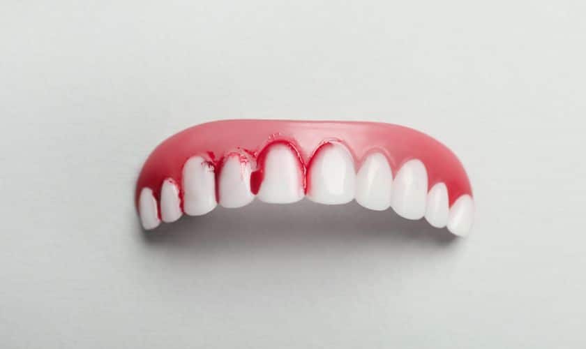 Tooth decay & gum disease