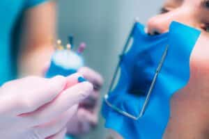 Endodontic Treatment