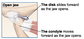 Diagram showing TMJ movement during jaw opening, with disk and condyle positioning.