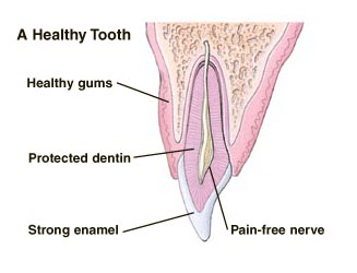 Anatomical diagram of a healthy tooth showing gums, enamel, dentin, and nerve structure.