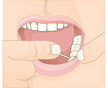 Illustration showing proper dental floss technique between teeth.