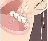 Animated illustration showing proper flossing technique between upper teeth.
