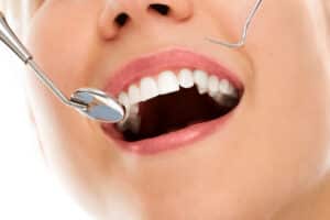 Restorative Dental Care
