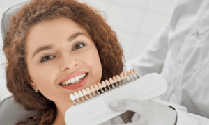 Why You Should Consider Professional Teeth Whitening