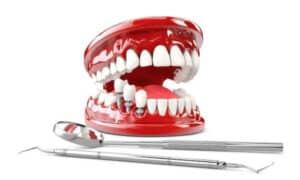 Common Myths Surrounding Dental Implants