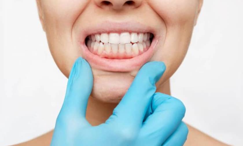 How To Prevent Gum Disease From Ruining Your Smile