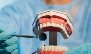 Dental model with teeth undergoing examination using dental mirror and suction tool in clinical setting.