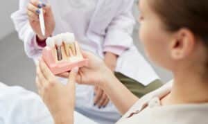 Dental Implants