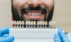 Teeth Whitening