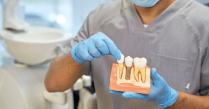 dental implants in Tullahoma