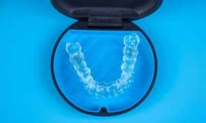 Invisalign in Tullahoma