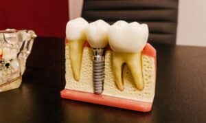 Dentistry in Tullahoma- Glick & Woods