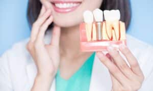 Dental implants in tullahoma- Glick and Woods Dentistry