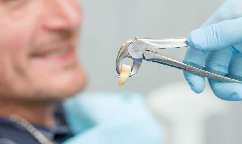 Tooth Extraction Tullahoma