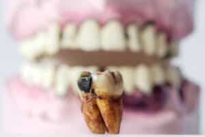 Smell Cavities