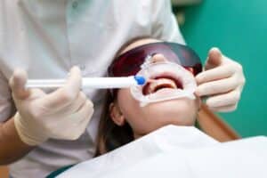 tooth colored fillings in Winchester and Tullahoma