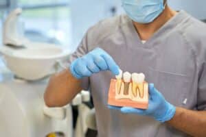 Can Dental Implants Fall Out