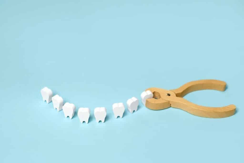 Tooth Extraction In Tullahoma