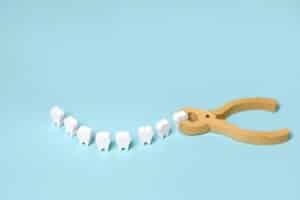 Tooth Extraction In Tullahoma