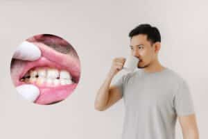 Does Black Coffee Erode Tooth Enamel