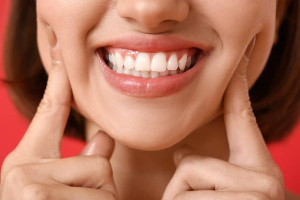 How To Fix a Gummy Smile