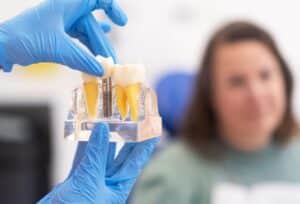 dental implants in Tullahoma