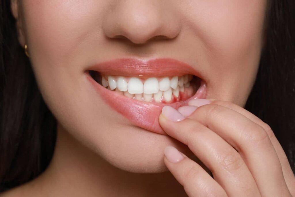 Treat a Tooth Infection